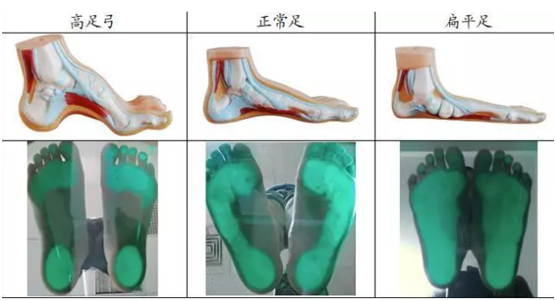 耐樂途功能鞋 保護兒童足部健康發(fā)育 陪伴孩子快樂成長